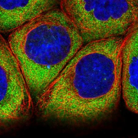 Immunocytochemistry/ Immunofluorescence - Anti-ATXN2L antibody (AB184834)