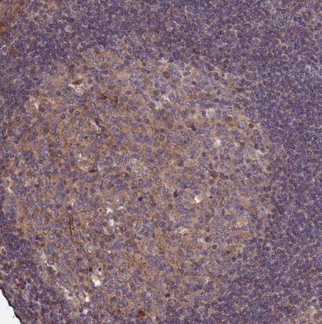 Immunohistochemistry (Formalin/PFA-fixed paraffin-embedded sections) - Anti-ATXN2L antibody (AB184834)