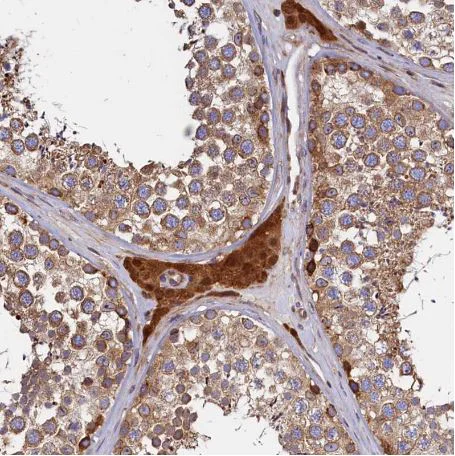 Immunohistochemistry (Formalin/PFA-fixed paraffin-embedded sections) - Anti-ATXN2L antibody (AB184834)