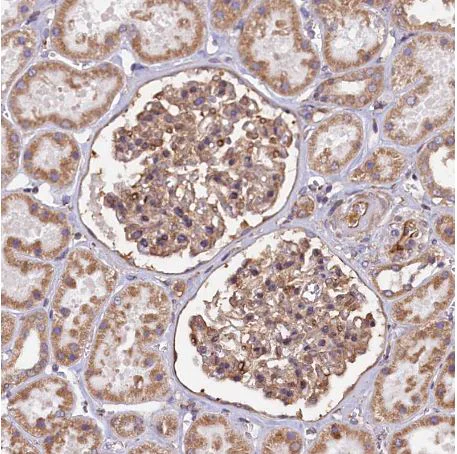 Immunohistochemistry (Formalin/PFA-fixed paraffin-embedded sections) - Anti-ATXN2L antibody (AB184834)
