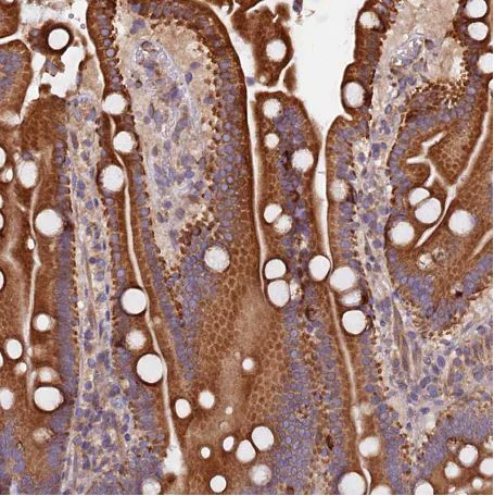 Immunohistochemistry (Formalin/PFA-fixed paraffin-embedded sections) - Anti-ATXN2L antibody (AB184834)