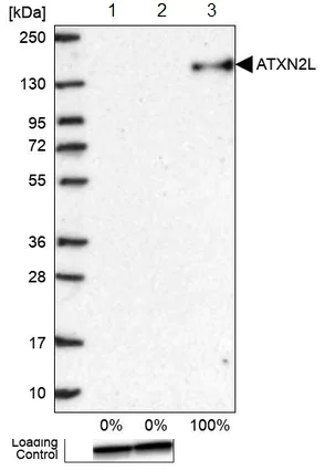 Western blot - Anti-ATXN2L antibody (AB184834)