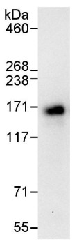Immunoprecipitation - Anti-ATXN2L antibody (AB99304), expandable thumbnail
