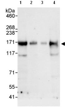 Western blot - Anti-ATXN2L antibody (AB99304), expandable thumbnail