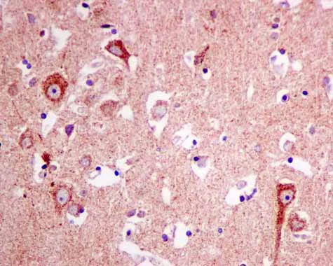 Immunohistochemistry (Formalin/PFA-fixed paraffin-embedded sections) - Anti-AUH antibody [EPR11087(B)] - BSA and Azide free (AB215823)