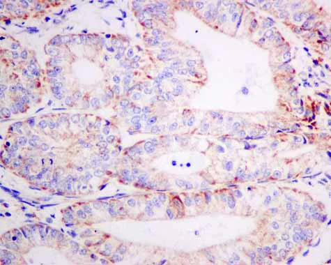 Immunohistochemistry (Formalin/PFA-fixed paraffin-embedded sections) - Anti-AUH antibody [EPR11087(B)] - BSA and Azide free (AB215823)