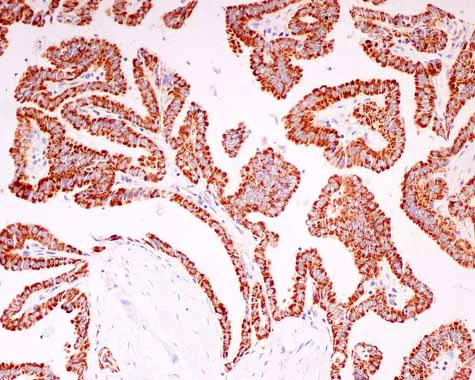 Immunohistochemistry (Formalin/PFA-fixed paraffin-embedded sections) - Anti-AUH antibody [EPR11087(B)] - BSA and Azide free (AB215823)