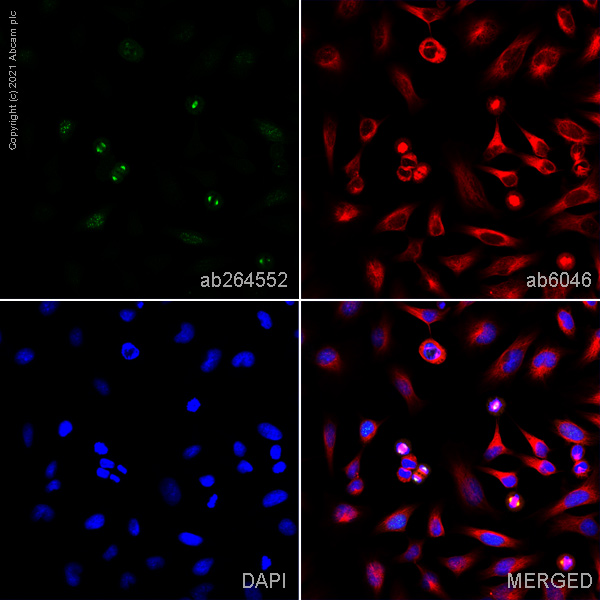 Immunocytochemistry/ Immunofluorescence - Anti-Aurora A antibody [35C1] (AB13824), expandable thumbnail