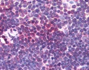 Immunohistochemistry (Formalin/PFA-fixed paraffin-embedded sections) - Anti-Aurora A antibody (AB115883)