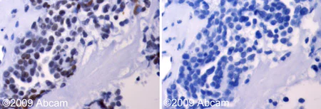 Immunohistochemistry (Formalin/PFA-fixed paraffin-embedded sections) - Anti-Aurora A antibody (AB61114)