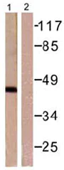 Western blot - Anti-Aurora A antibody (AB61114)