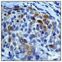 Immunohistochemistry (Formalin/PFA-fixed paraffin-embedded sections) - Anti-Aurora A antibody [EP1008Y] - BSA and Azide free (AB232013)
