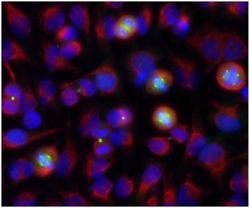 Immunocytochemistry/ Immunofluorescence - Anti-Aurora A + B antibody [3H1] (AB190374)