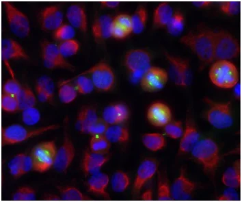 Immunocytochemistry/ Immunofluorescence - Anti-Aurora A + B antibody [3H1] (AB190374)