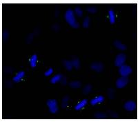 Immunocytochemistry/ Immunofluorescence - Anti-Aurora A (phospho T288) antibody (AB83968)
