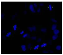 Immunocytochemistry/ Immunofluorescence - Anti-Aurora A (phospho T288) antibody (AB83968)