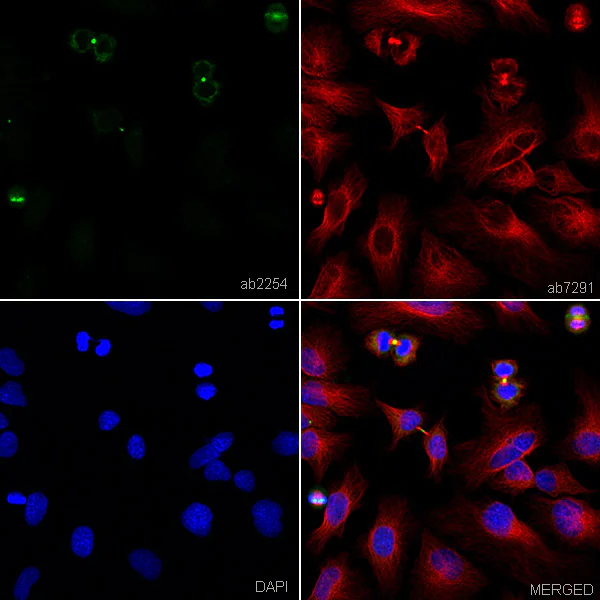 Immunocytochemistry/ Immunofluorescence - Anti-Aurora B antibody (AB2254)
