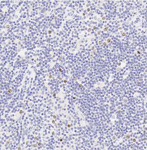 Immunohistochemistry (Formalin/PFA-fixed paraffin-embedded sections) - Anti-Aurora B antibody (AB2254)