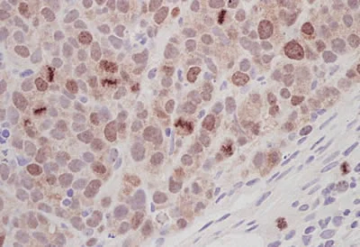 Immunohistochemistry (Formalin/PFA-fixed paraffin-embedded sections) - Anti-Aurora B antibody (AB2254)