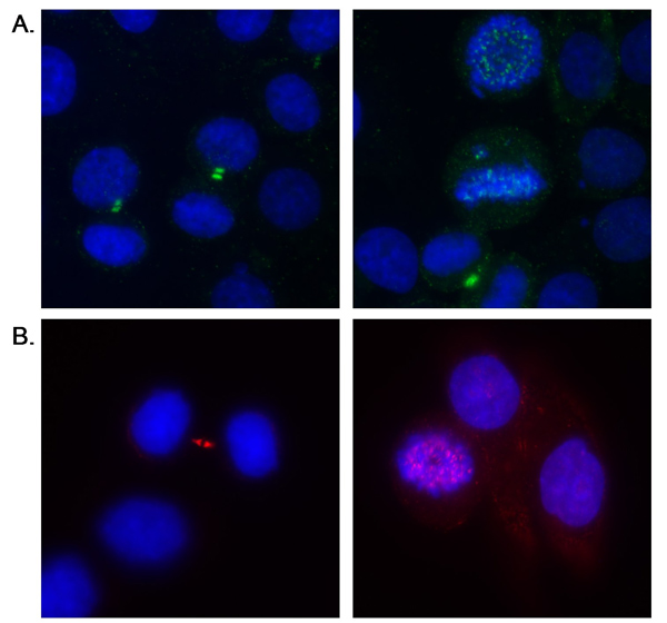 Immunocytochemistry - Anti-Aurora B antibody (AB70238), expandable thumbnail