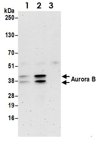 Immunoprecipitation - Anti-Aurora B antibody (AB70238), expandable thumbnail