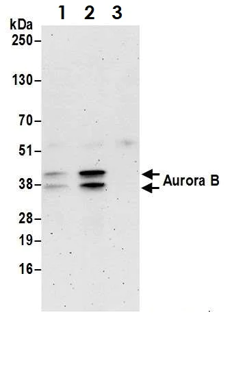 Immunoprecipitation - Anti-Aurora B antibody (AB70238)
