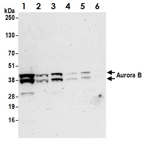 Western blot - Anti-Aurora B antibody (AB70238), expandable thumbnail