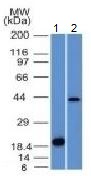 Western blot - Anti-Aurora B antibody [AURKB/1521] (AB218339), expandable thumbnail