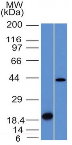 Western blot - Anti-Aurora B antibody [AURKB/1521] - BSA and Azide free (AB269754), expandable thumbnail