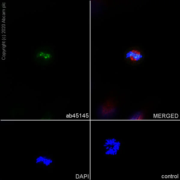 Immunocytochemistry/ Immunofluorescence - Anti-Aurora B antibody [EP1009Y] (AB45145)