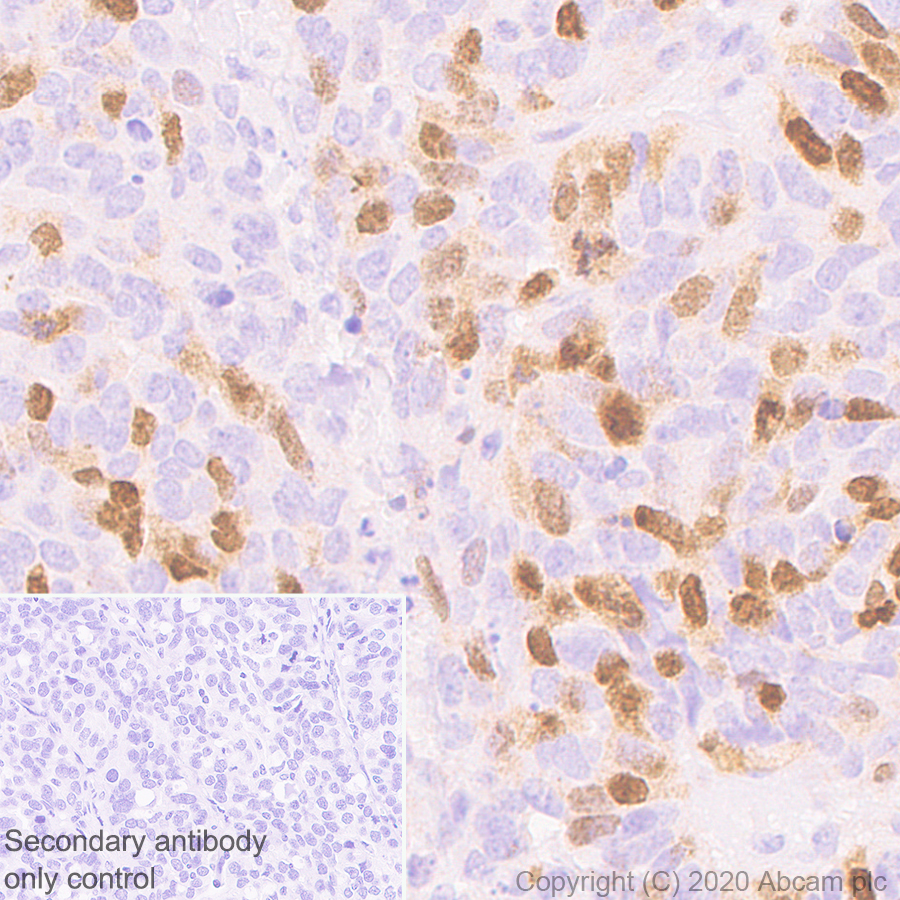 Immunohistochemistry (Formalin/PFA-fixed paraffin-embedded sections) - Anti-Aurora B antibody [EP1009Y] (AB45145), expandable thumbnail