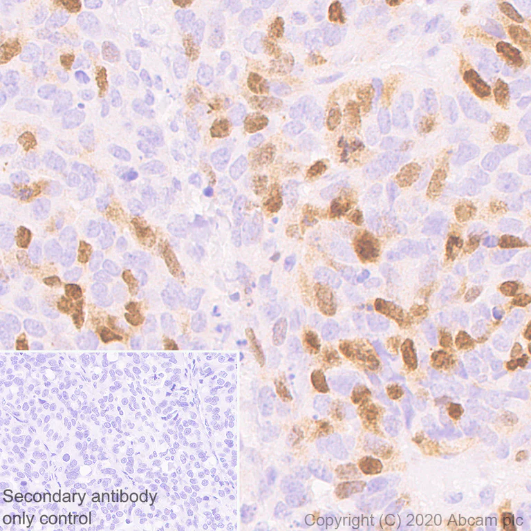 Immunohistochemistry (Formalin/PFA-fixed paraffin-embedded sections) - Anti-Aurora B antibody [EP1009Y] (AB45145)