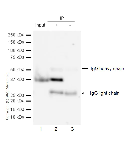 Immunoprecipitation - Anti-Aurora B antibody [EP1009Y] (AB45145)