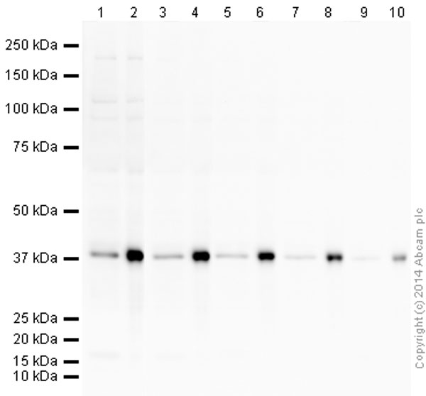 Western blot - Anti-Aurora B antibody [EP1009Y] (AB45145), expandable thumbnail
