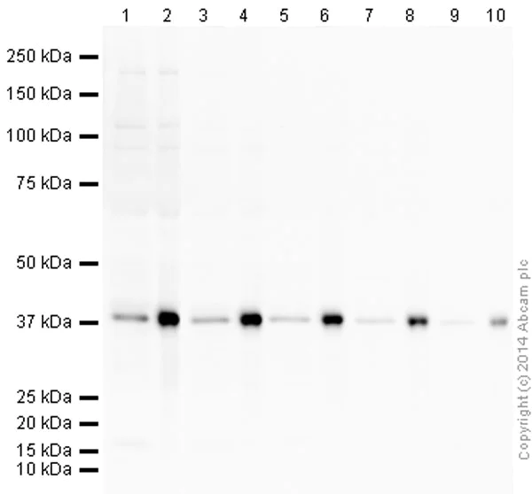 Western blot - Anti-Aurora B antibody [EP1009Y] (AB45145)