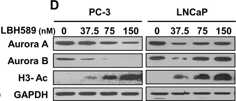 Western blot - Anti-Aurora B antibody [EP1009Y] (AB45145)