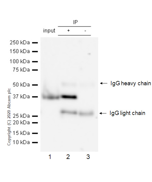 Immunoprecipitation - Anti-Aurora B antibody [EP1009Y] - BSA and Azide free (AB239837), expandable thumbnail