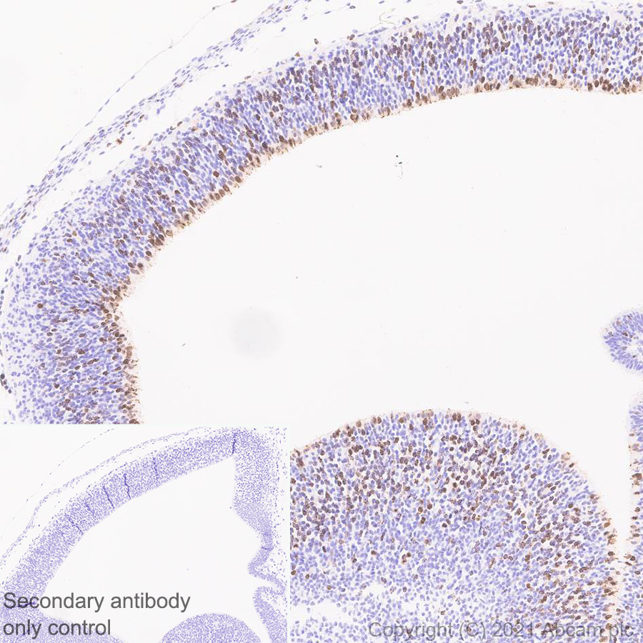 Immunohistochemistry (Formalin/PFA-fixed paraffin-embedded sections) - Anti-Aurora B antibody [EPR25417-73] (AB287960)