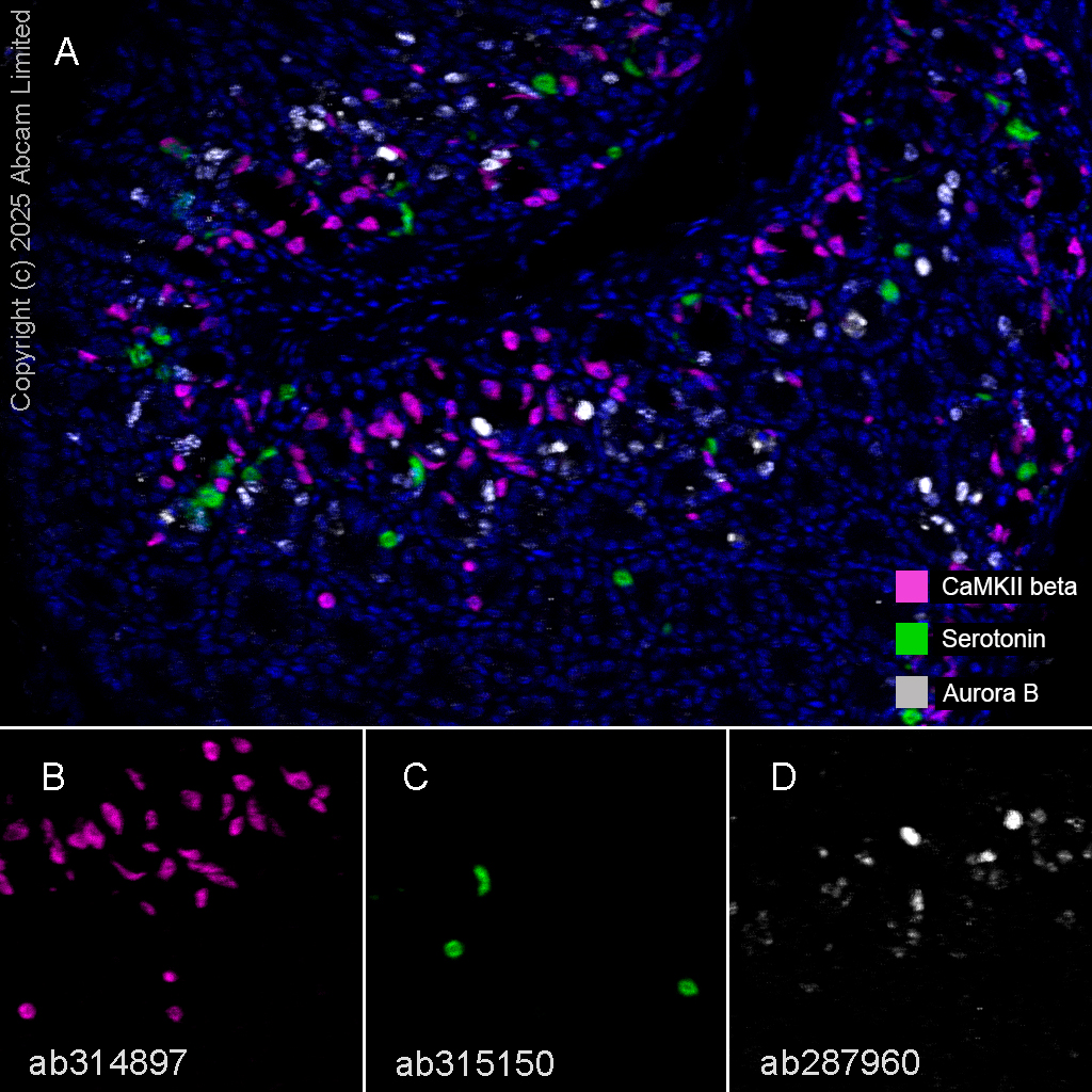 Multiplex immunohistochemistry - Anti-Aurora B antibody [EPR25417-73] (AB287960)