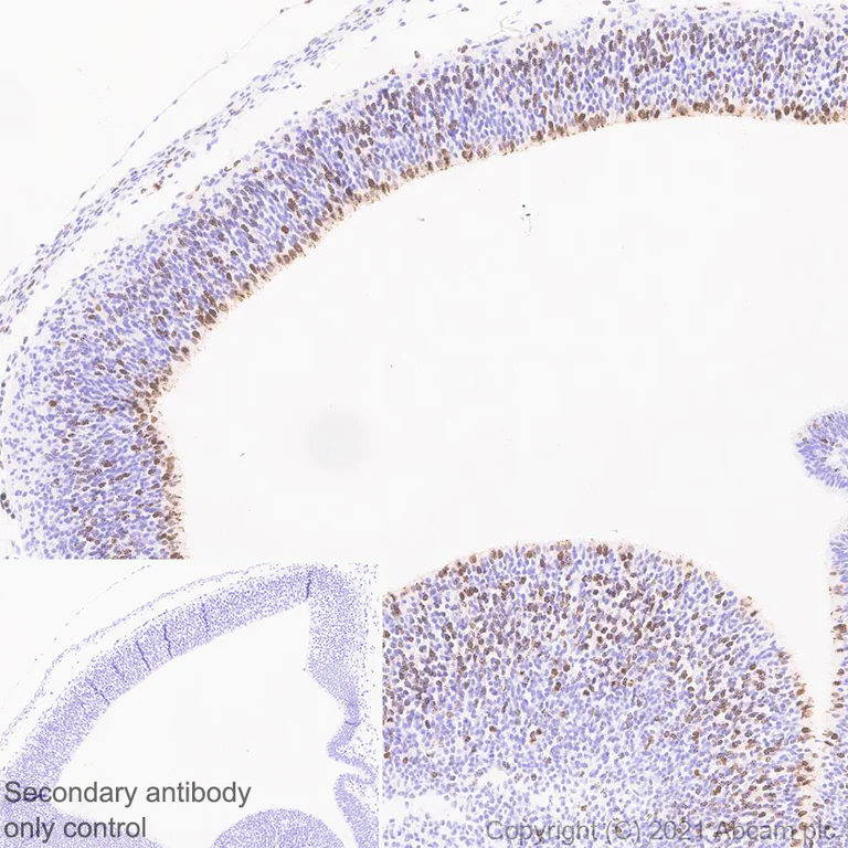 Immunohistochemistry (Formalin/PFA-fixed paraffin-embedded sections) - Anti-Aurora B antibody [EPR25417-73] - BSA and Azide free (AB287965)