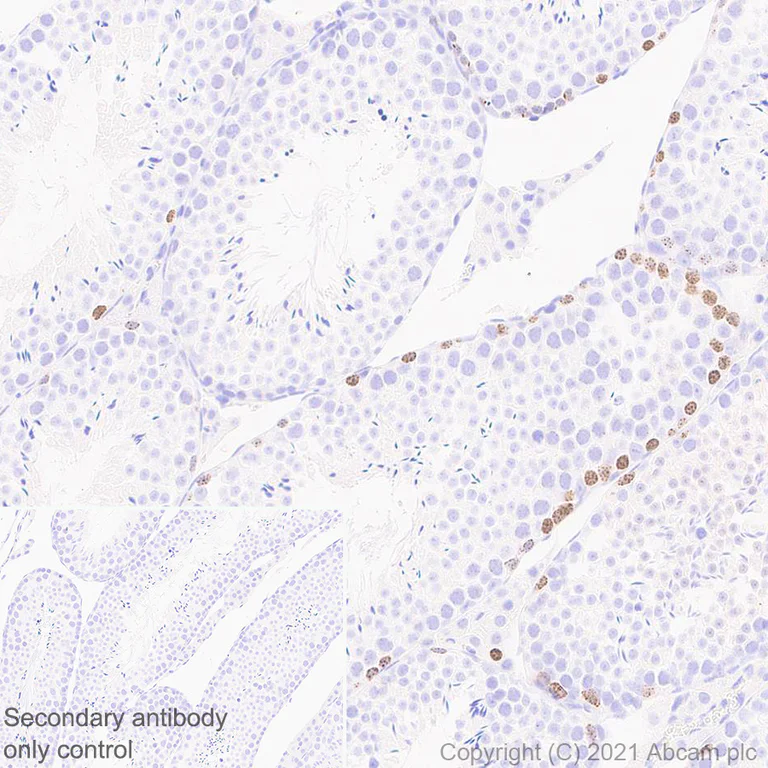 Immunohistochemistry (Formalin/PFA-fixed paraffin-embedded sections) - Anti-Aurora B antibody [EPR25417-73] - BSA and Azide free (AB287965)