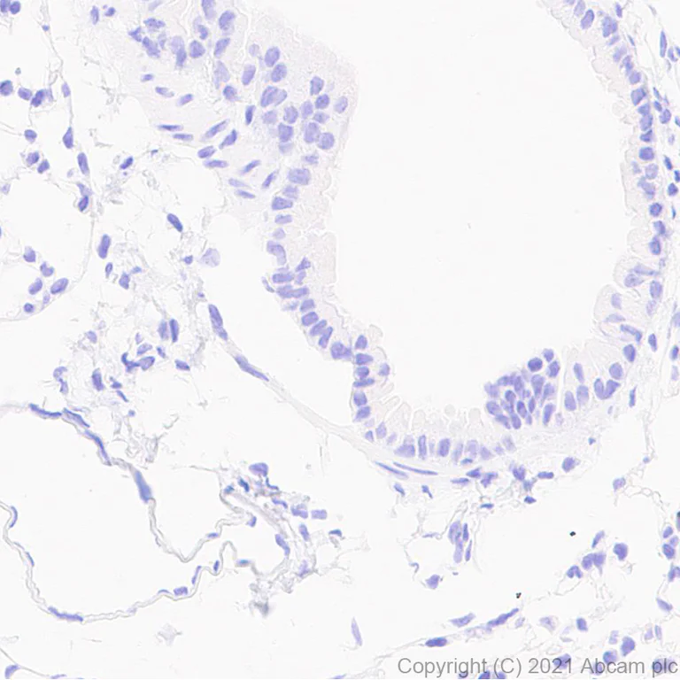Immunohistochemistry (Formalin/PFA-fixed paraffin-embedded sections) - Anti-Aurora B antibody [EPR25417-73] - BSA and Azide free (AB287965)