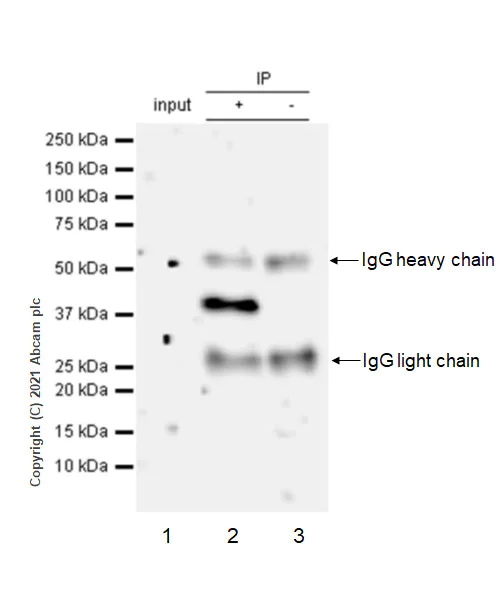 Immunoprecipitation - Anti-Aurora B antibody [EPR25417-73] - BSA and Azide free (AB287965)