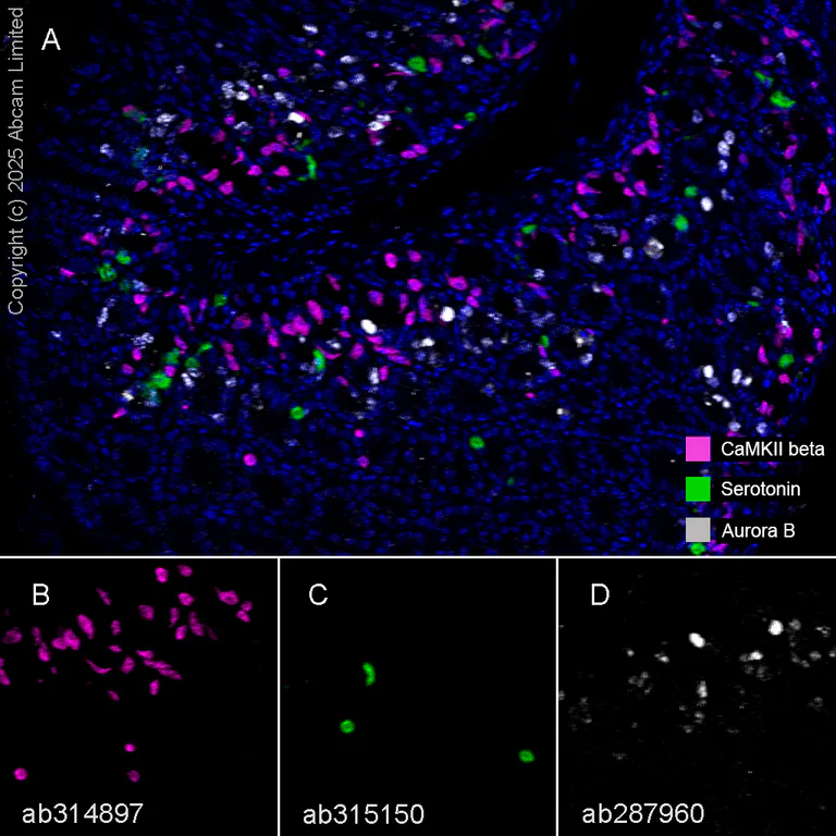 Multiplex immunohistochemistry - Anti-Aurora B antibody [EPR25417-73] - BSA and Azide free (AB287965)