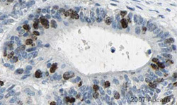 Immunohistochemistry (Formalin/PFA-fixed paraffin-embedded sections) - Anti-Aurora B antibody [mAbcam 3609] (AB3609), expandable thumbnail