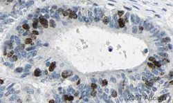 Immunohistochemistry (Formalin/PFA-fixed paraffin-embedded sections) - Anti-Aurora B antibody [mAbcam 3609] (AB3609)