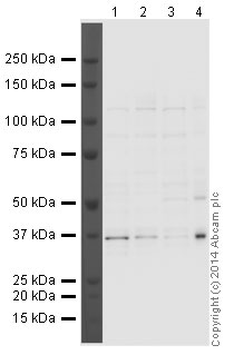 Western blot - Anti-Aurora B antibody [mAbcam 3609] (AB3609), expandable thumbnail