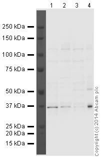 Western blot - Anti-Aurora B antibody [mAbcam 3609] (AB3609)