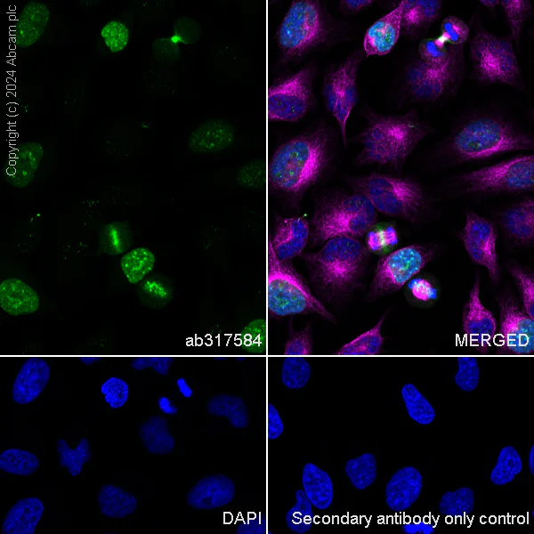 Immunocytochemistry/ Immunofluorescence - Anti-Aurora B antibody [RM1185] (AB317584)