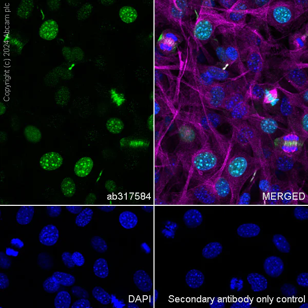 Immunocytochemistry/ Immunofluorescence - Anti-Aurora B antibody [RM1185] (AB317584)
